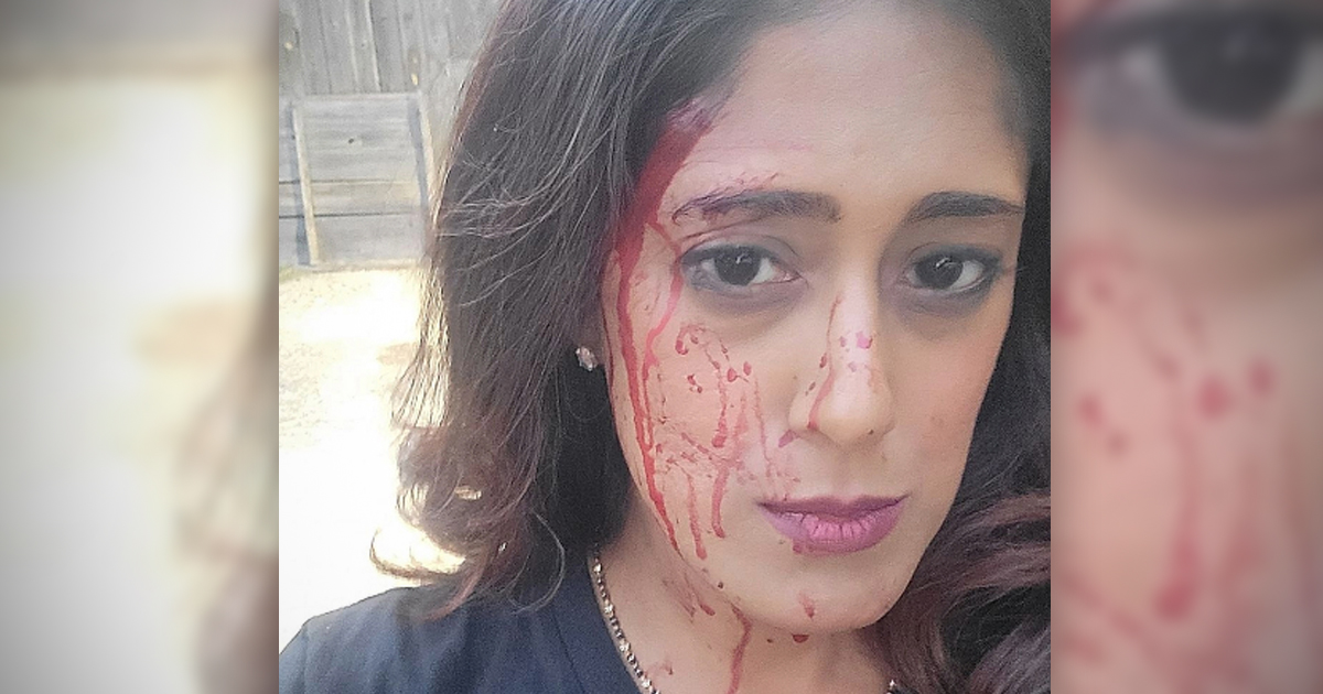 Woman with blood on her face and hair